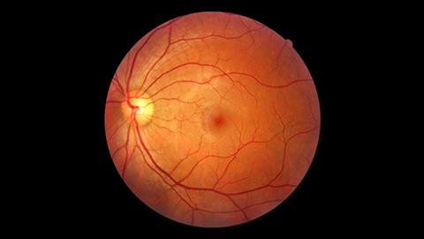 Retinal Exam